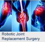 Robotic Joint Replacement Surgery